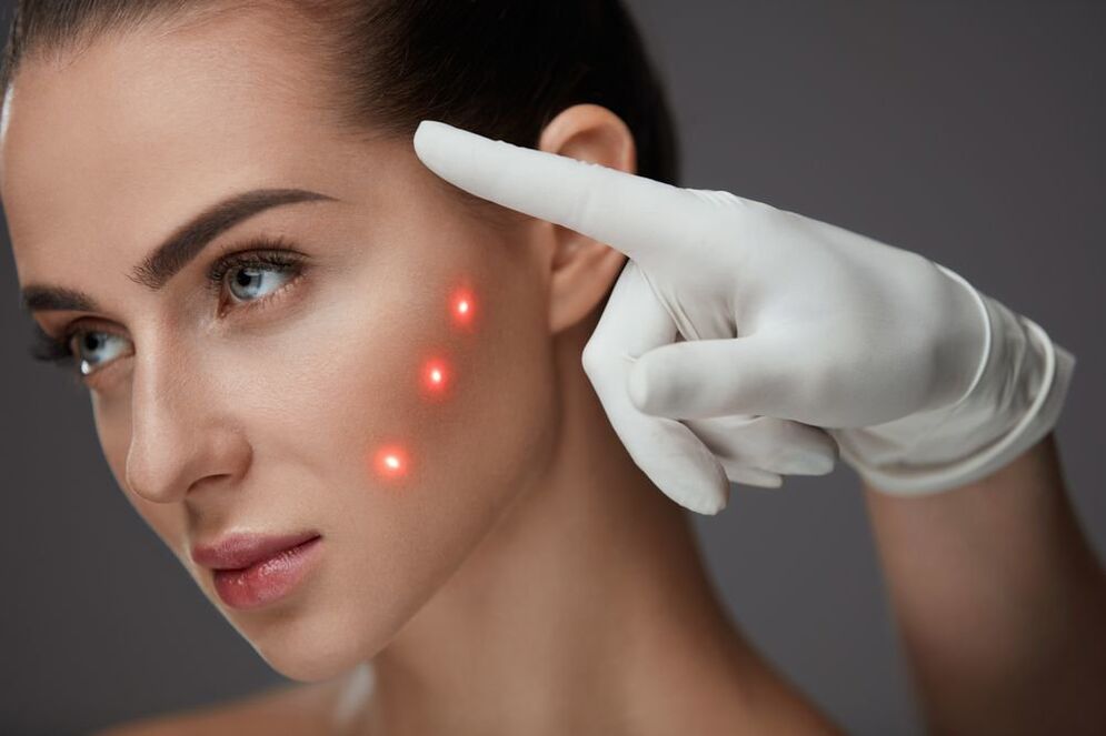 preparation for laser resurfacing