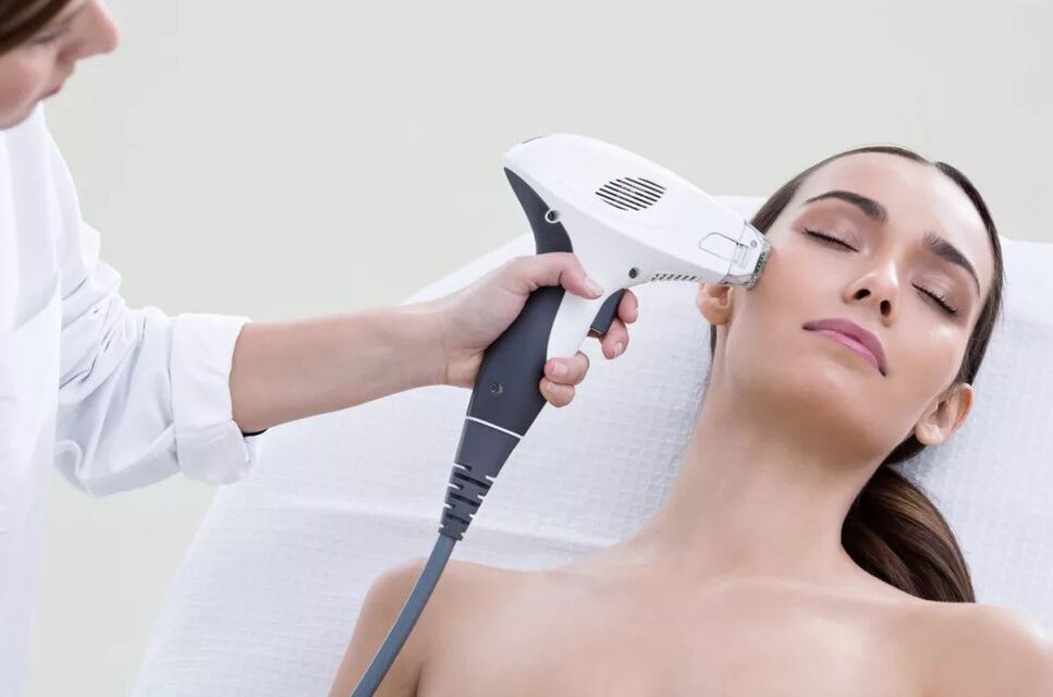 Field rejuvenation by a laser