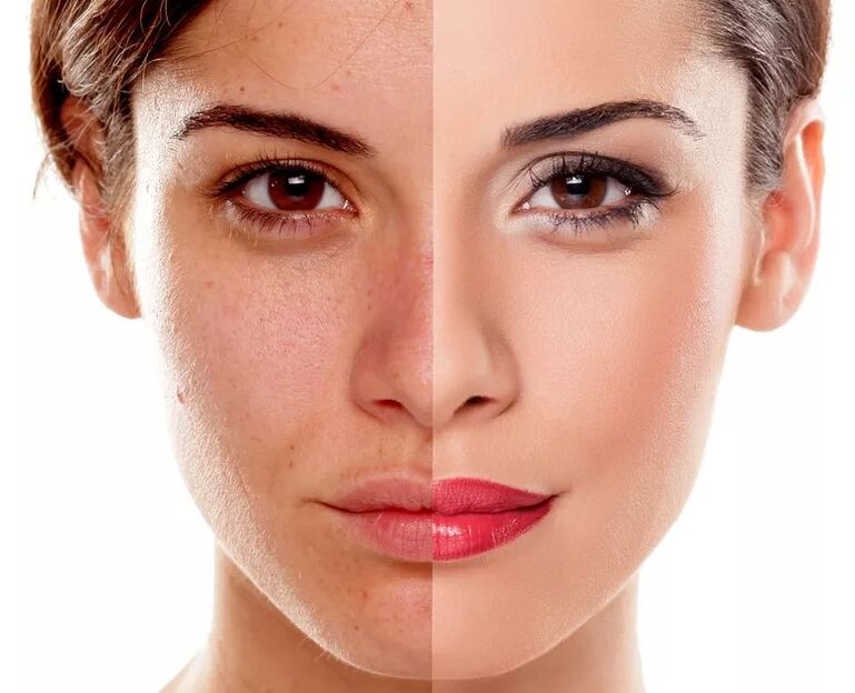Flat skin tone